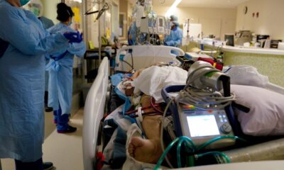 Urlhttps3a2f2fcalifornia Times Brightspot.s3.amazonaws.com2f1b2f312f8e6857a44d6daca1a51bc41982a32f554915 Sd Me Covid Ecmo 020.jpg